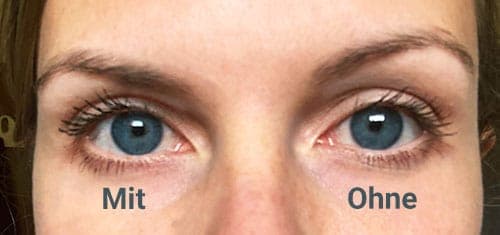 babypuder probleme loesen