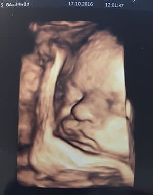 3D-Ultraschallbild aus dem Klinikum