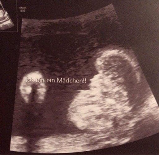 ultraschall 21 ssw maedchen