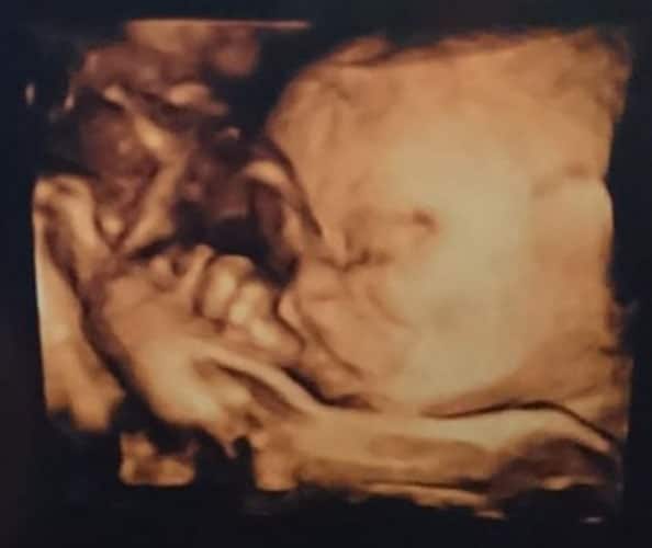 ultraschall 28 ssw junge