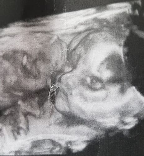 ultraschall 29 ssw junge