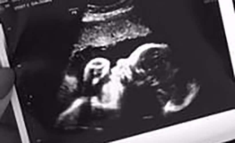 ultraschall 33 ssw junge