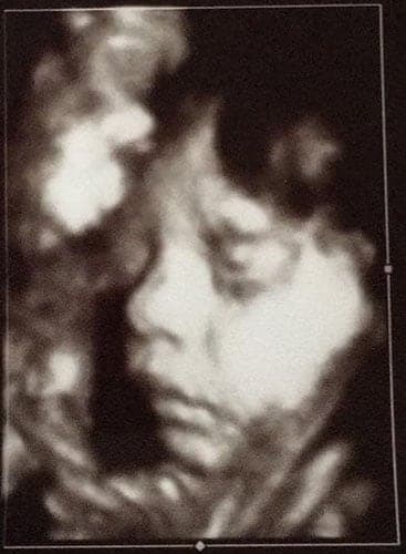 ultraschall 34 ssw junge